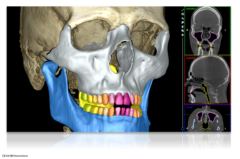 Planmeca presenterà nuovi strumenti basati su intelligenza artificiale per Planmeca Romexis®